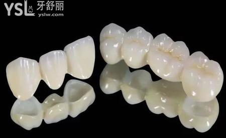 一般的全烤瓷牙多少錢一顆？