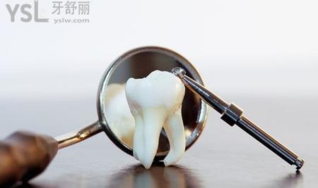  我最近有一顆牙經(jīng)常疼,是怎么回事？