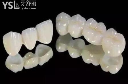 拔牙之后如果不補牙有什么影響？