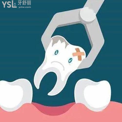 拔牙后需要注意什么事項？