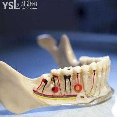 牙齒神經(jīng)痛會(huì)自動(dòng)痊愈嗎？