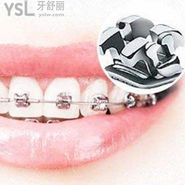 我想問下牙齒矯正醫(yī)保能報(bào)銷嗎？