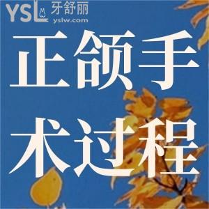 正頜手術(shù)過程是怎么樣的？