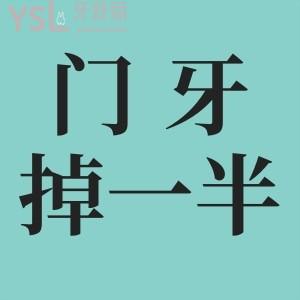 門牙掉一半修復多少錢？怎么修復