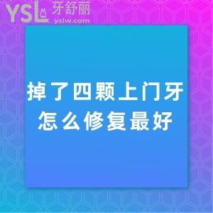 掉了四顆上門牙怎么修復(fù)較好,選擇種植牙不知價(jià)格貴不貴？
