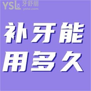 補一次牙能維持多久？