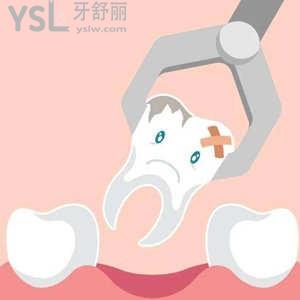 成人牙齒松動能自己拔掉嗎？