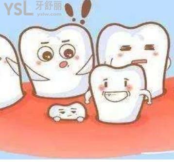 成人為什么還會有多生牙 還要拔嗎？