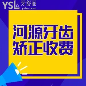 河源牙齒矯正收費(fèi)多少錢?并推薦適合學(xué)生矯正的牙科價(jià)格劃算