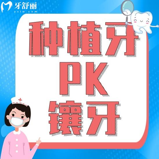 種植牙和鑲牙哪個(gè)比較好一點(diǎn)？應(yīng)該選擇哪個(gè)？