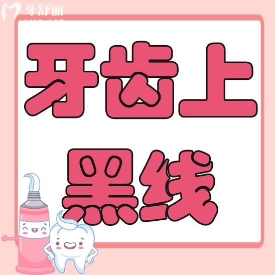 牙齒上的黑線一定是蛀牙嗎？一定要補(bǔ)牙治療嗎