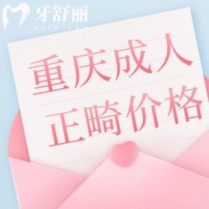 重慶成人牙齒正畸多少錢(qián)?價(jià)格1-4萬(wàn)還有技術(shù)好醫(yī)院排名前十分享