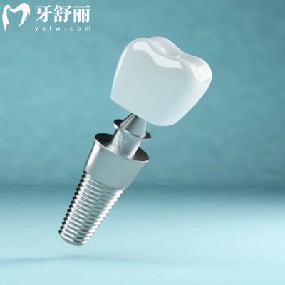更新西安種植牙收費(fèi)價(jià)目表：單顆2369/半口18878元/全口30000元起