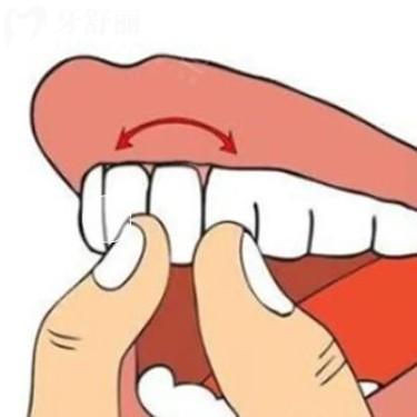 牙齒用手晃有點(diǎn)松動(dòng)正常嗎？會(huì)自己長(zhǎng)好嗎？