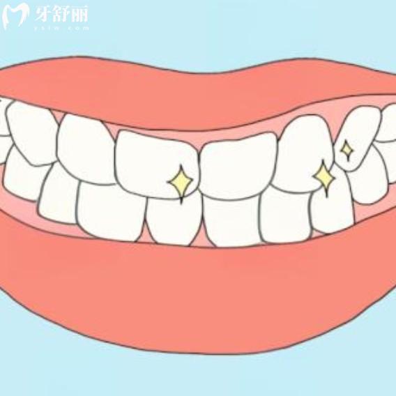 30歲做了滿口烤瓷牙能用一輩子嗎？老了還能用嗎？
