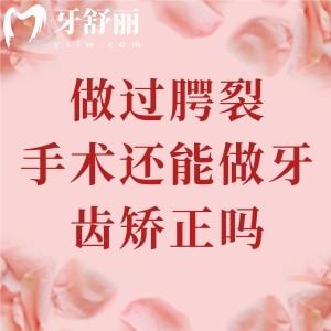 做過(guò)腭裂手術(shù)還能做牙齒矯正嗎？