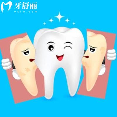 牙齒美白的方法哪種有效？是不是智商稅？