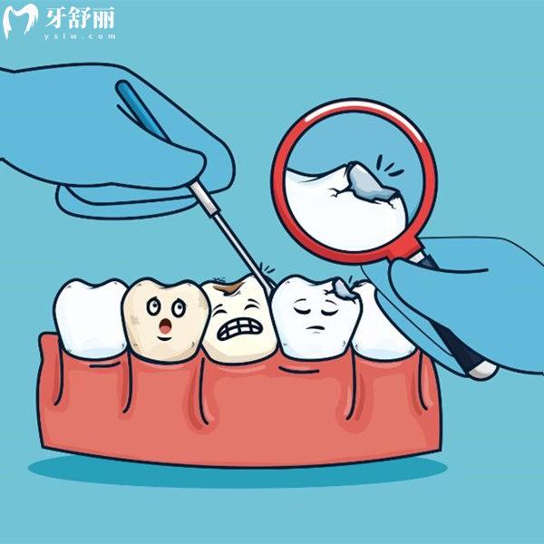齲壞后補(bǔ)了牙的牙齒還會(huì)爛到牙髓么?