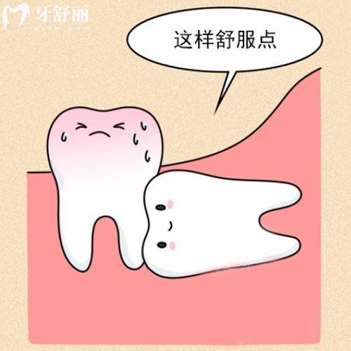 簡(jiǎn)單智齒和復(fù)雜智齒如何判斷?