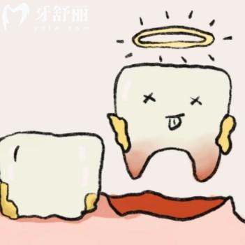 先洗牙還是先拔牙補(bǔ)牙？