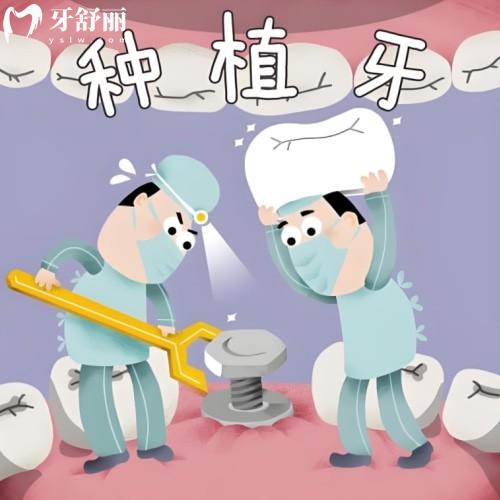 2025青島可恩口腔醫(yī)院種植牙價(jià)目表公布單顆多顆半口全口種植牙價(jià)格一覽表