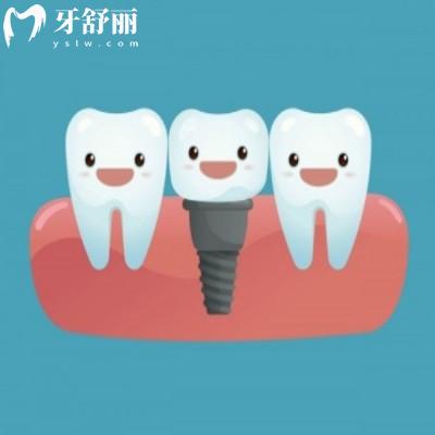 2025鄭州二七區(qū)口腔醫(yī)院價格表:含種植牙/牙齒矯正點擊查看收費標(biāo)準(zhǔn)