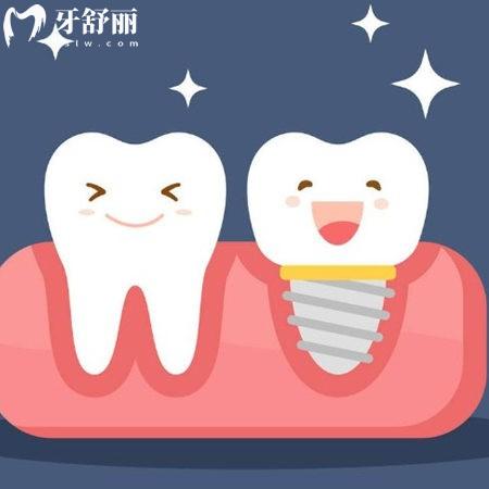 濟(jì)南可恩口腔收費(fèi)高嗎?(種植牙3280+隱形矯正9999+)價(jià)格不高|屬于中高端檔次