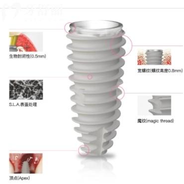 韓國(guó)紐百特種植體質(zhì)量如何？從材質(zhì)、技術(shù)及適用人群各方面解讀