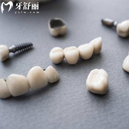 烤瓷牙多少錢一顆價(jià)格表2025，鎳鉻400+鈷鉻800+鈦合金1500+