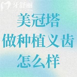 美冠塔做種植義齒怎么樣?中老年口腔?？品?wù)更加專注/技術(shù)更加齊全