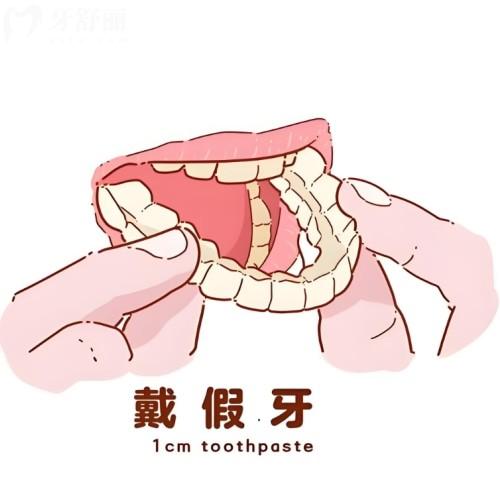 年輕人用什么假牙比較好?年輕人裝假牙能吃硬東西嗎?這份指南讓你吃得香笑得更自信