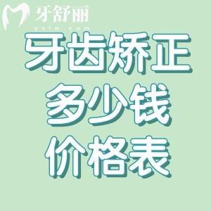 牙齒矯正多少錢2025價格表:矯正牙收費價目表詳細包含金屬/陶瓷/隱形全系列價格