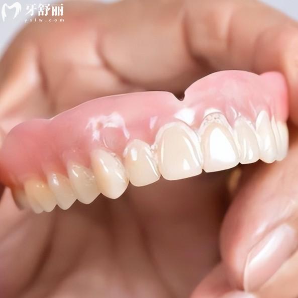 2025活動假牙十大品牌盤點：國產(chǎn)進(jìn)口品牌優(yōu)缺點一一解讀